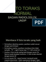 KKD 2.2 X Foto Toraks Normal