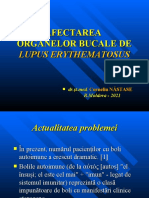 Lupus PPT