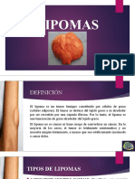 LIPOMAS