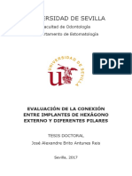 Evaluacion de La Conexion Entre Implantes de Hexagono Externo y Dif Pilares