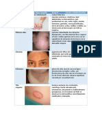 Diferencial de Pitriasis Versicolor