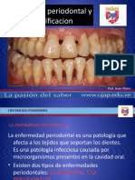 Clasificación de Las Enfermedades Periodontales