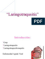 Laringotraqueitis