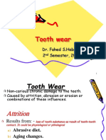 2 - Tooth Wear