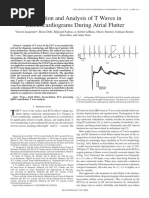 Extract Analysis T-Waves ECG Atrial Flutter Vinet