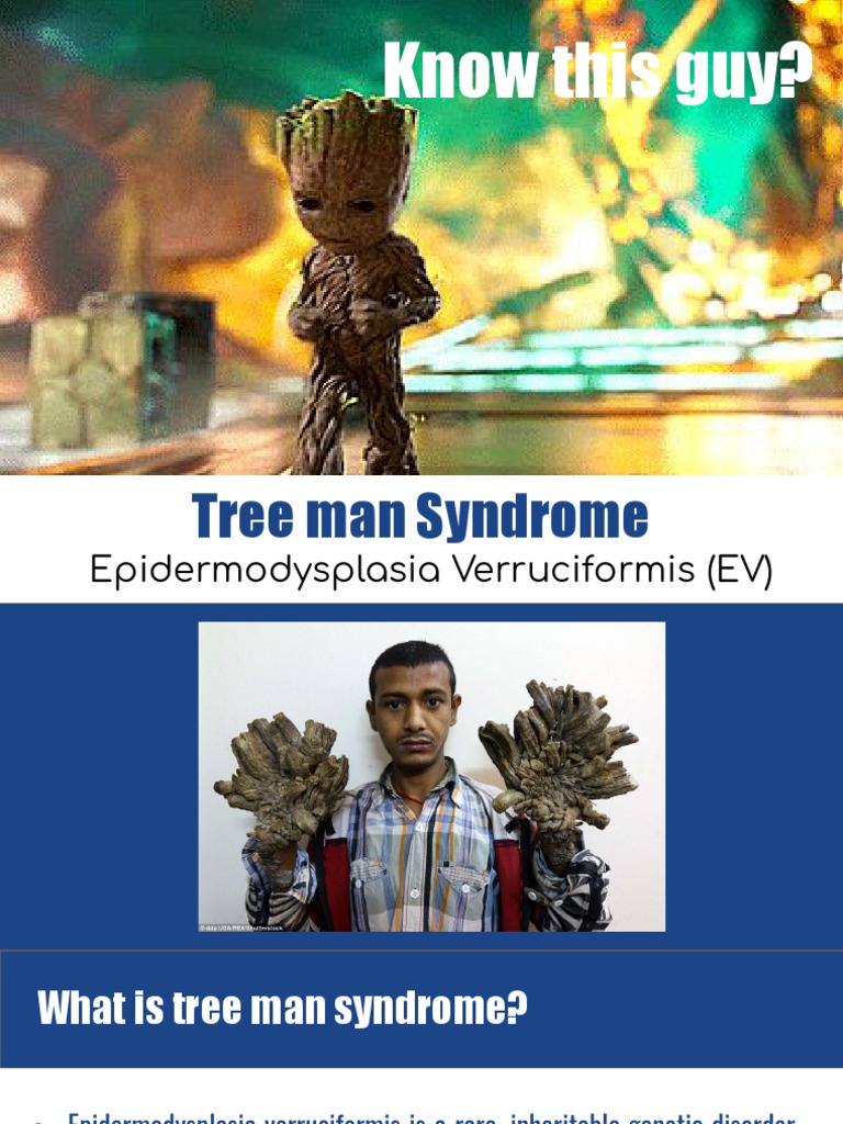 Tree Man Syndrome PDF