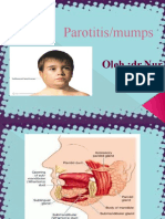 Parotitis