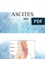 ASCITES