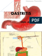 GASTRITIS