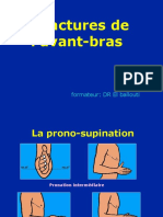 11- Avant -bras - Fractures (1)