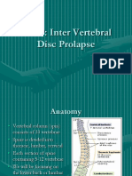 IVDP: Inter Vertebral Disc Prolapse