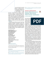 Severe Mitral Stenosis in Patients With Severe Mitral Annular Calci Fication