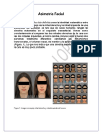 Capitulo 35. Diagnóstico y tratamiento de las asimetrias faciales. 
