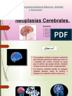 Neoplasias cerebrales: causas, síntomas y tipos