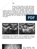 Jurding 3 Case Presentation