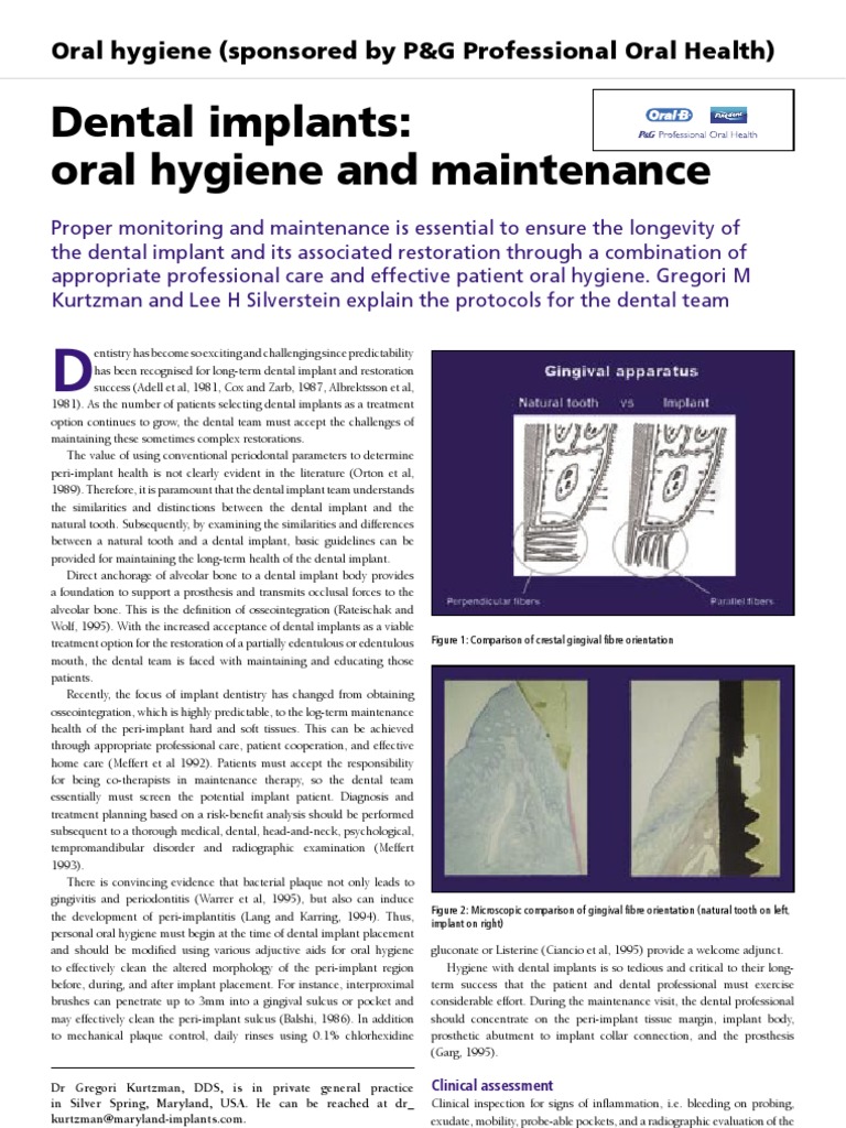 Dental Implants Oral Hygiene and Maintenance Oral Hygiene (Sponsored