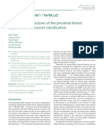 Periprosthetic Fractures of The Proximal Femur Beyond The Vancouver Classification