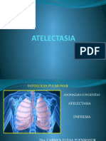 Atelectasia