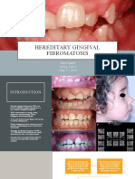 Chahal Paul S1611 HereditaryGingivalFibromatosis