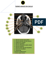 Imágenes Axiales en Cuello, Torax Bien