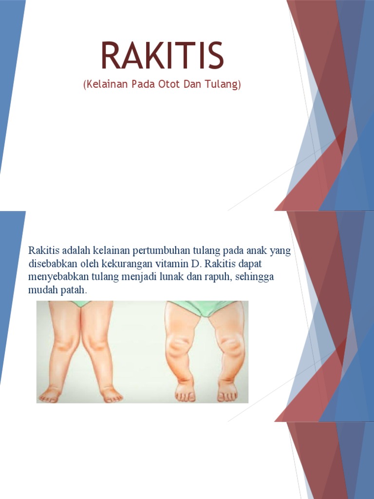 Rakitis | PDF | Kesehatan Holistik | Sains & Matematika