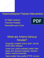 Haemodialysis Fistula Intervention - DR Ralph Jackson