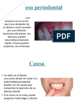 Absceso Periodontal