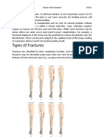 Fracture Anatomy