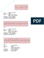 Ekg Rial