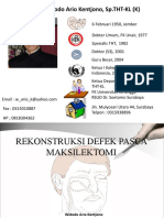 Rekonstruksi Defek Pasca Maksilektomi-Bandung 2013