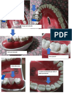 Daño A Periodonto