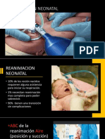 Reanimación Neonatal