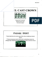 Dowel Cast Crown
