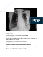 Describir La RX de Torax