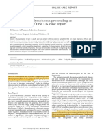 Adult Burkitt's Lymphoma Presenting As. Uk PDF
