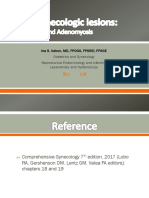 Endometriosis Adenomyosis Dr-Irabon