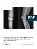 Comparison of Outcome of Unilateral Locking Plate and Dual Plating in The Treatment of Bicondylar Tibial Plateau Fractures