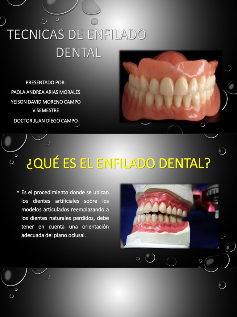 Técnicas de Enfilado Dental | PDF | Anatomia dental | Boca