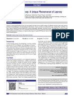 Lazarine Leprosy: A Unique Phenomenon of Leprosy: Case Report