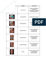 Musculos Expresion Facial