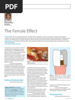 Download ferrule effect by Alin Ciortea SN49849145 doc pdf