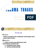 Trauma Toraks 1 - Dr. Rachim