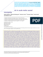 Conduction Block in Acute Motor Axonal