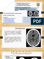 Calcificaciones fisiologicas