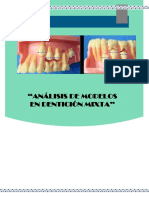 Análisis de Modelos en Dentición Mixta