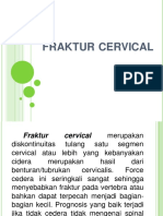 Faktur Cervical