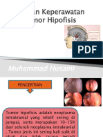 Tumor Hipofisis