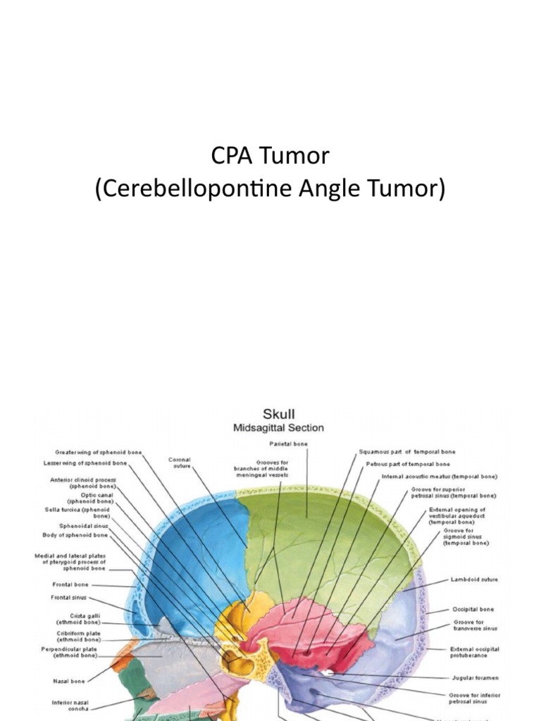 Cerebellopontine Angle Tumor Overview | PDF