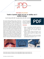 Transfer of Posterior Palatal Seal Area On Maxillary Cast: A Modified Technique