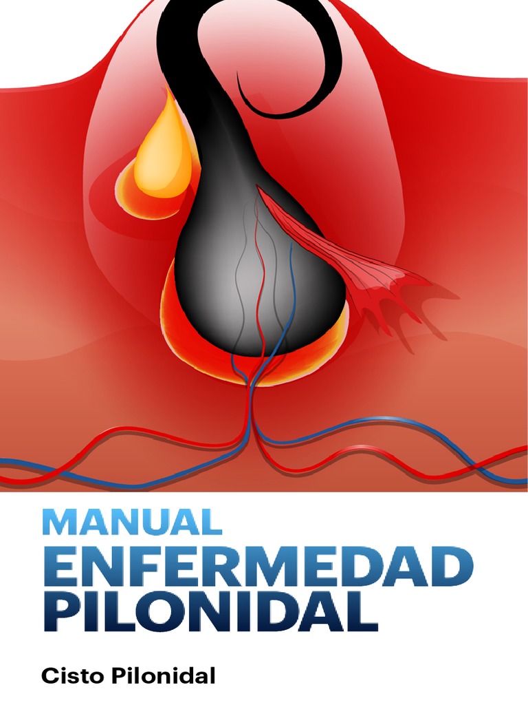 Manual para Enfermedad Pilonidal | PDF | Cirugía | Anestesia